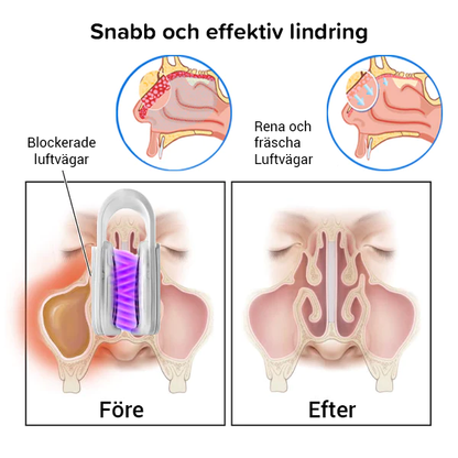 Andas väl Rengöringsanordning för nässlem