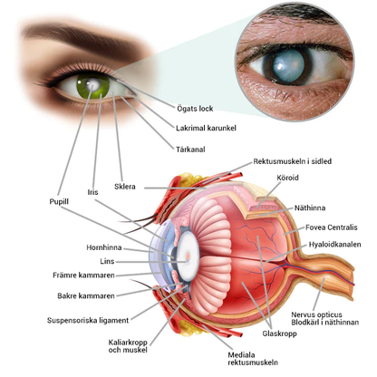 OphthalPro Enhet för synförbättring