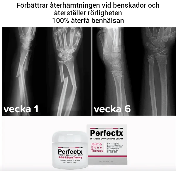 Perfectx led- och benterapikräm