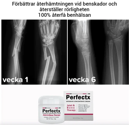 Perfectx led- och benterapikräm