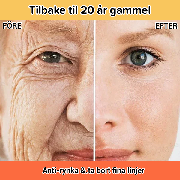 Botox ansiktsserum