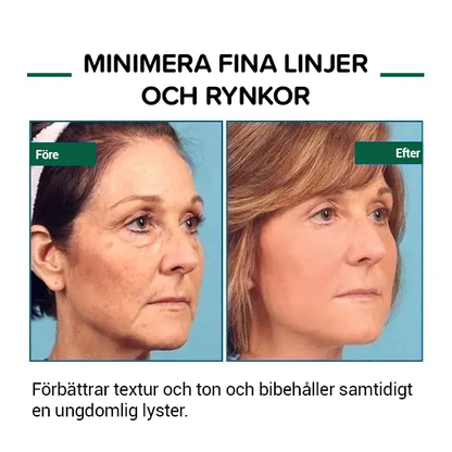 Botox ansiktsserum