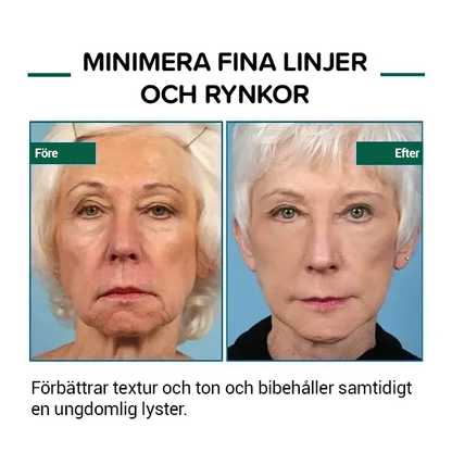 Botox ansiktsserum