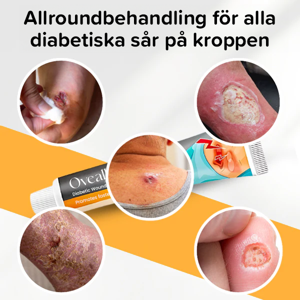 Kräm för behandling av diabetessår