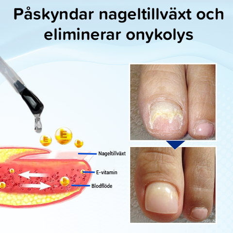 OnyxoGuard Nageltillväxt och reparationsserum