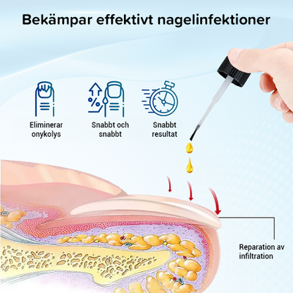 OnyxoGuard Nageltillväxt och reparationsserum