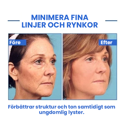 Botox ansiktsserum