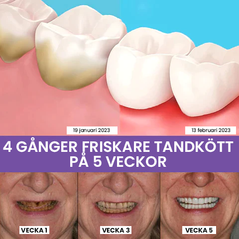 Serum för korrigering av tandfärg