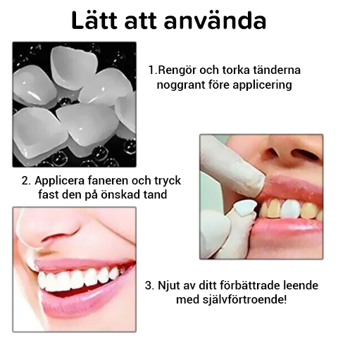 Dentala tillfälliga kronfaner